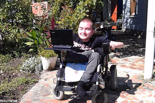 Valery Spiridonov, người tình nguyện tham gia ca phẫu thuật ghép đầu đầu tiên thế giới