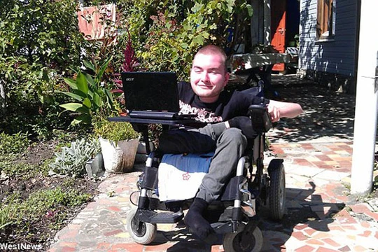 Valery Spiridonov, người tình nguyện tham gia ca phẫu thuật ghép đầu đầu tiên thế giới