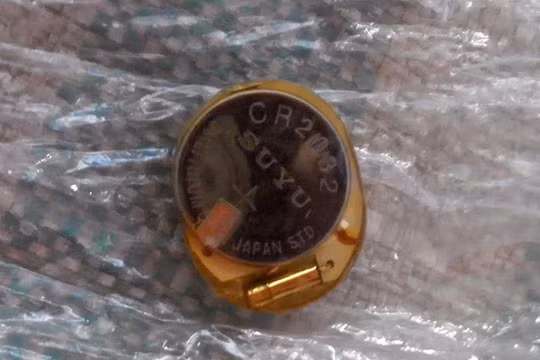 Nghi vấn bé trai ngất xỉu vì vật lạ trong áo