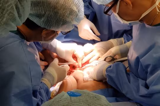 Gần 100 bác sĩ tham gia ca đại phẫu tách rời hai bé Trúc Nhi - Diệu Nhi (Ảnh: BVCC)