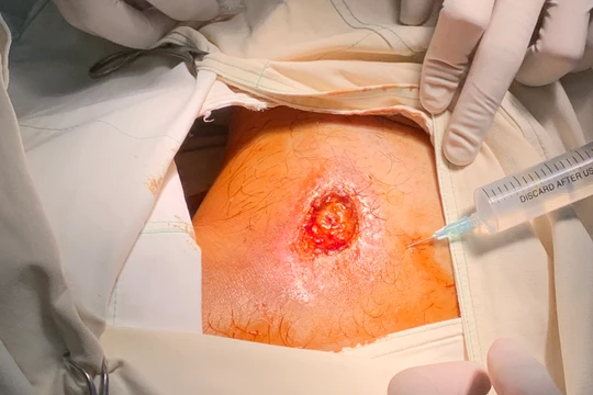 Ảnh chụp trong quá trình điều trị cho bệnh nhân sau khi nhập viện vào BV Quốc tế Minh Anh (Nguồn: BVCC)