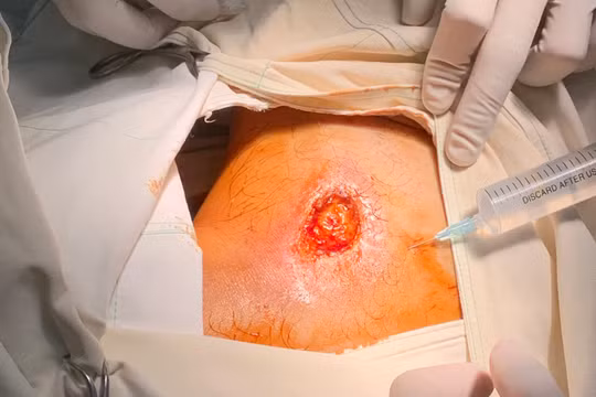 Ảnh chụp trong quá trình điều trị cho bệnh nhân sau khi nhập viện vào BV Quốc tế Minh Anh (Nguồn: BVCC)