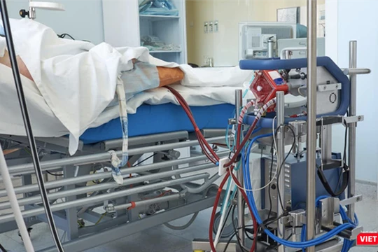 Bệnh nhân 91 phi công người Anh đang phụ thuộc hoàn toàn vào kỹ thuật ECMO (tim phổi nhân tạo) - Ảnh: SYT