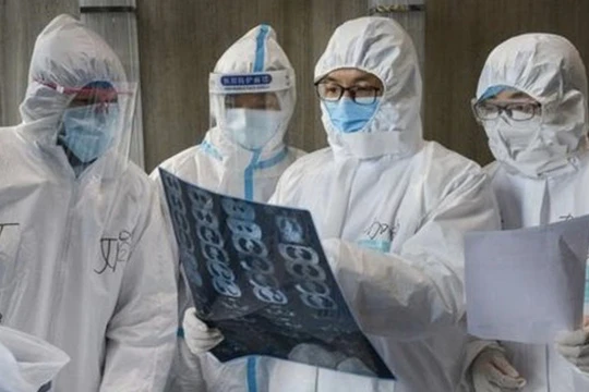 Để điều trị cách ly bệnh nhân nghi nhiễm COVID-19, đội ngũ y tế cũng cần được trang bị bảo hộ (Ảnh: BV Bệnh Nhiệt đới cung cấp)