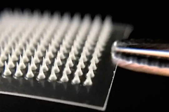 Miếng dán gồm rất nhiều mũi kim siêu nhỏ có thể đánh tan mỡ thừa hiệu quả. Ảnh: Sciencealert