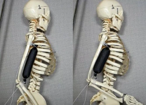 Cơ bắp nhân tạo được sử dụng để nâng cánh tay của bộ xương lên 90 độ. Ảnh: Aslan Miriyev/Columbia Engineering.