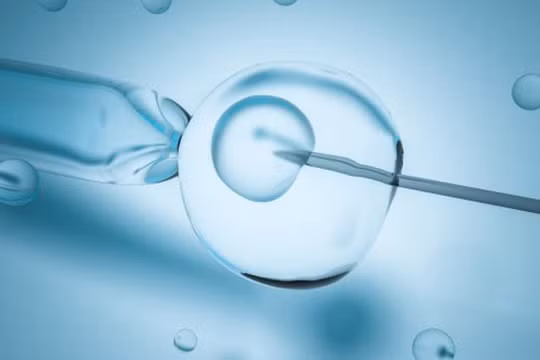 Ảnh minh họa (Futurism)