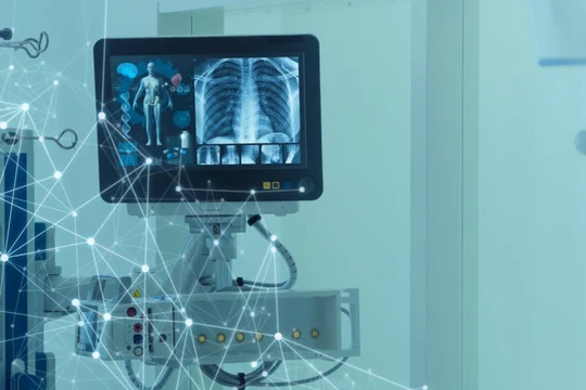 Công nghệ AI giúp việc chẩn đoán các bệnh về phổi trở nên dễ dàng và chính xác hơn (Ảnh: IE)