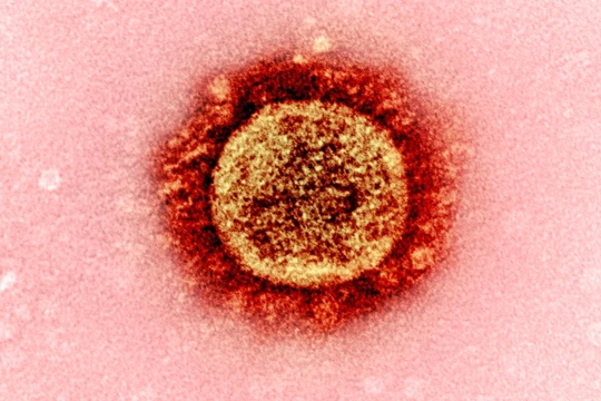 Công nghệ CRISPR làm ngưng sự lan truyền của virus Corona trên người (Ảnh: Free Think)