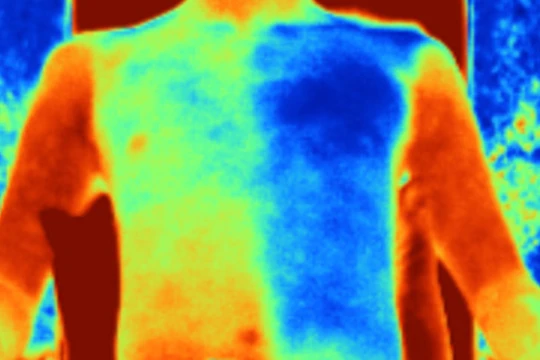 "Vải gương" giúp da người mặc mát hơn tới 5 độ C (Ảnh: Science Mag)