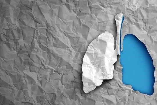 Các nhà khoa học tiến gần hơn đến việc in 3D cơ quan nội tạng của con người nhờ loại mực mới (Ảnh: The Hill)