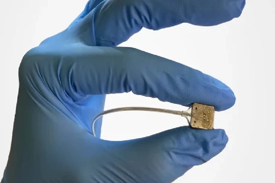 Mô đun chip cấy ghép trên vỏ não của Paradromics. Ảnh Paradromics