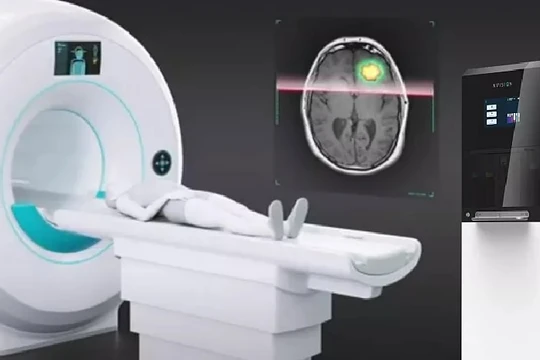 Công nghệ NVision giúp các bác sĩ phát hiện ung thư sớm hơn, thấy được kết quả trong vòng vài ngày khi sử dụng một liệu pháp điều trị. Ảnh Video NVision Imaging Technologies