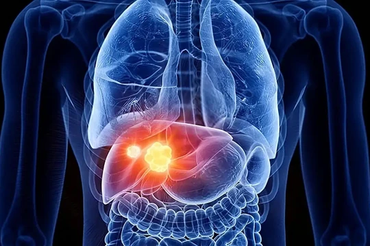 Các nhà khoa học UC San Diego tìm thấy protein ATF4 ngăn ngừa tổn thương gan và sự tiến triển thành ung thư Ảnh: UC San Diego