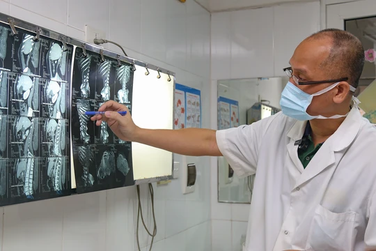 PGS.TS. Nguyễn Hồng Hà - Trưởng khoa Phẫu thuật Hàm mặt, Tạo hình và Thẩm mỹ, Bệnh viện Hữu nghị Việt Đức chẩn đoán hình ảnh bệnh lý của bệnh nhân