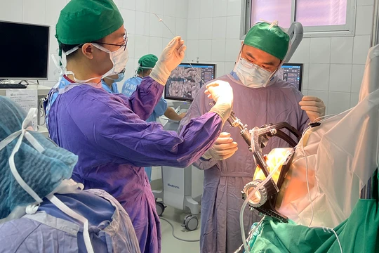 Các bác sĩ Bệnh viện hữu nghị Việt Đức đang phẫu thuật đặt điện cực kích thích não cho bệnh nhân mắc Parkinson