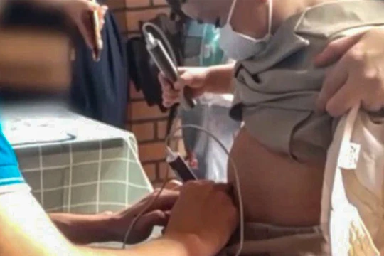 Nhân viên cơ sở y tế sử dụng "bút đo vi chất" đối với bệnh nhân nhi (ảnh chụp màn hình)