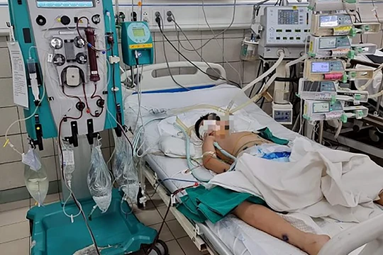 Bệnh nhi được điều trị kèm chỉ định lọc máu liên tục