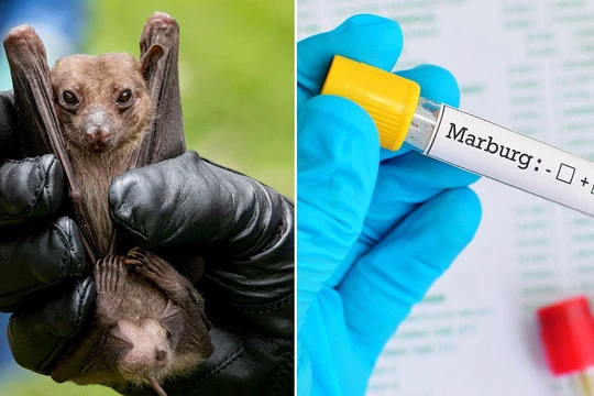 Bệnh Marburg là bệnh đặc biệt nguy hiểm, khả năng lây truyền và tỷ lệ tử vong cao. (Ảnh: tuoitre.vn)