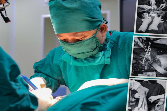 Các bác sĩ Bệnh viện đa khoa Đức Giang (Hà Nội) đang phẫu thuật nối chân cho bệnh nhân