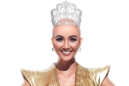 Quá lạ với hình ảnh hoa hậu H'Hen Niê không có tóc