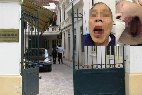 Ảnh minh họa. Nguồn: Báo Giao thông