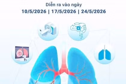 Bệnh viện Bạch Mai mở chương trình sàng lọc miễn phí ung thư phổi cho người nguy cơ