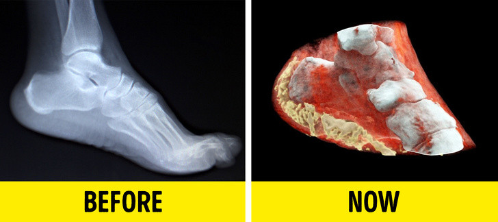 Ảnh: BrightSide Ảnh: BrightSide