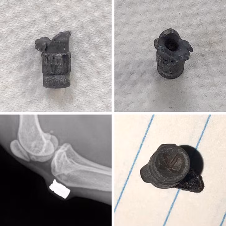 Ảnh: BrightSide Ảnh: BrightSide