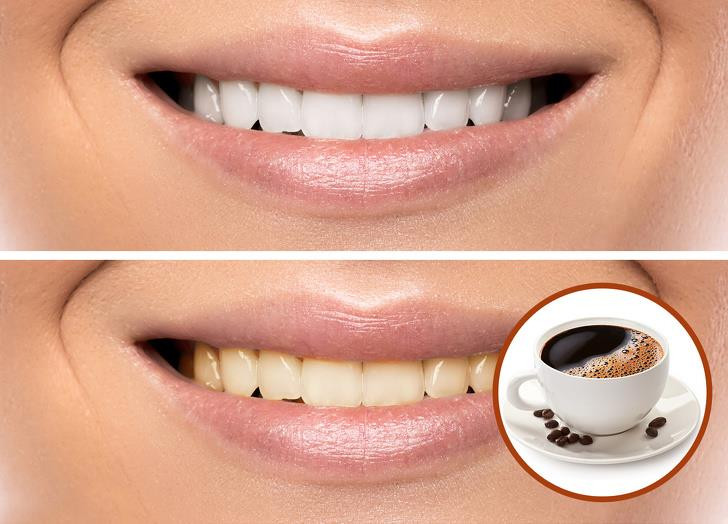 Ảnh: BrightSide Ảnh: BrightSide