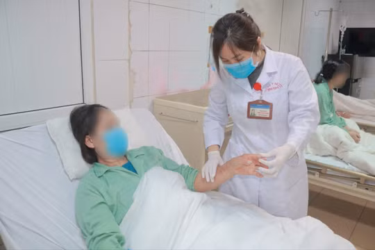 Nổ hóa chất thông bồn cầu đêm giáng sinh, người phụ nữ bỏng nặng