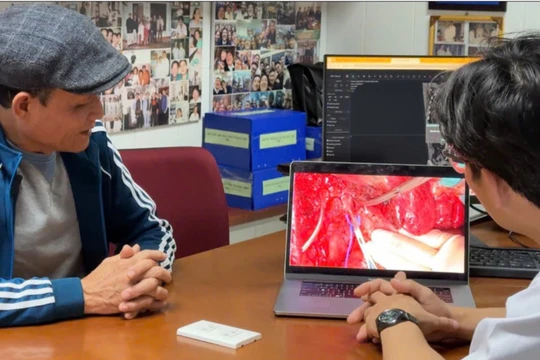 Tiên lượng chỉ sống được vài tháng vì ung thư gan, bệnh nhân sống khỏe 4 năm nhờ điều trị đa mô thức