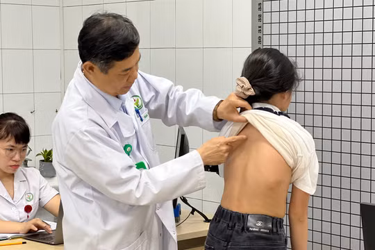 Phát hiện muộn, nhiều trẻ vẹo cột sống nặng bị biến dạng lồng ngực, mất cơ hội điều trị tối ưu