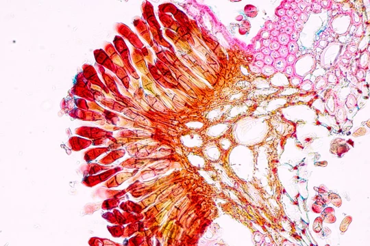 Ảnh minh họa: Getty.