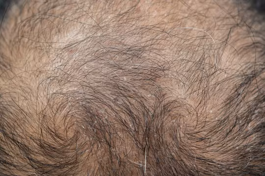 Ảnh minh họa: PM.