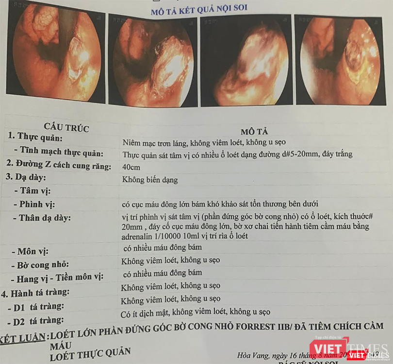 Kết quả chẩn đoán hình ảnh nội soi đối với bệnh nhân