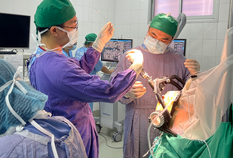 Các bác sĩ Bệnh viện hữu nghị Việt Đức đang phẫu thuật đặt điện cực kích thích não cho bệnh nhân mắc Parkinson
