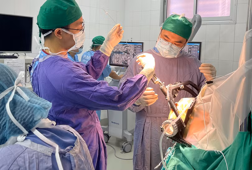 Các bác sĩ Bệnh viện hữu nghị Việt Đức đang phẫu thuật đặt điện cực kích thích não cho bệnh nhân mắc Parkinson