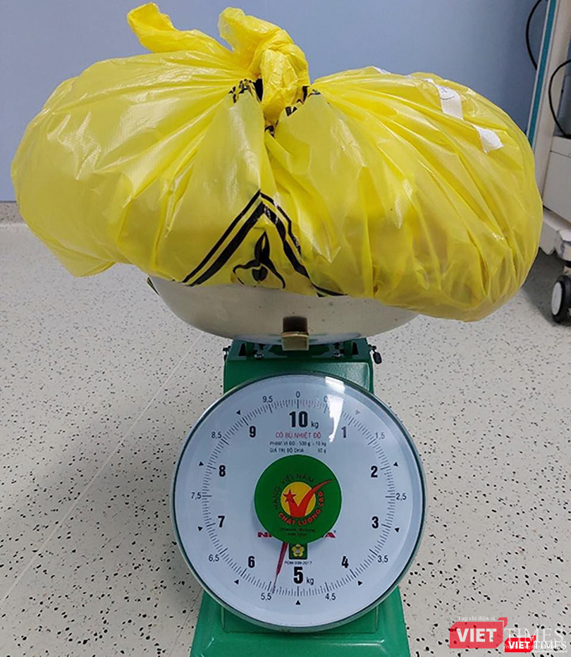 Khối u được lấy ra từ bụng bệnh nhân M.