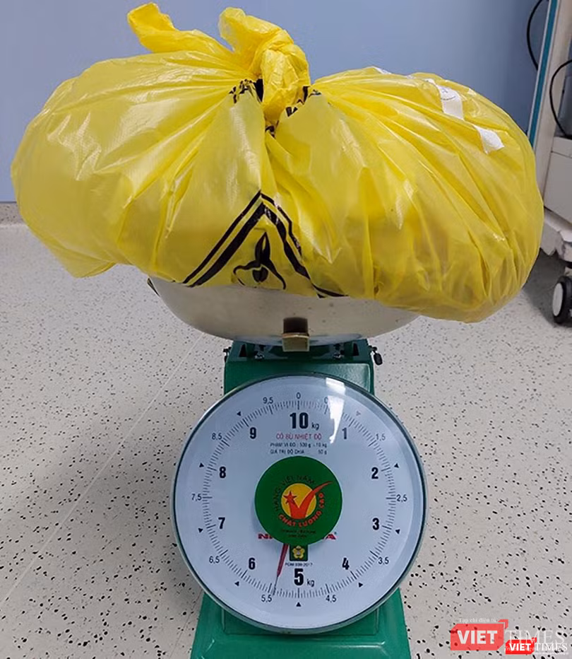 Khối u được lấy ra từ bụng bệnh nhân M.