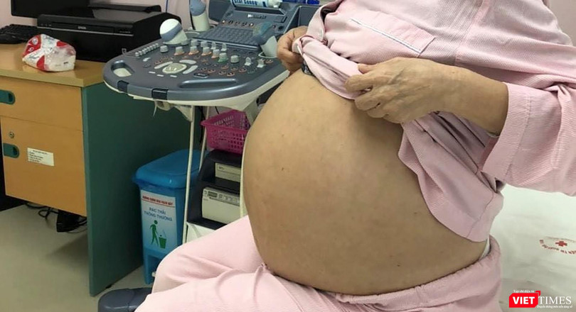 Bệnh nhân M. trước khi phẫu thuật