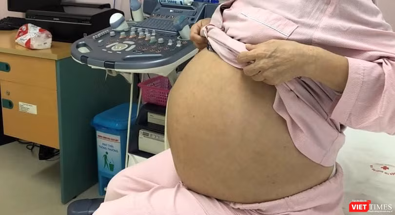 Bệnh nhân M. trước khi phẫu thuật