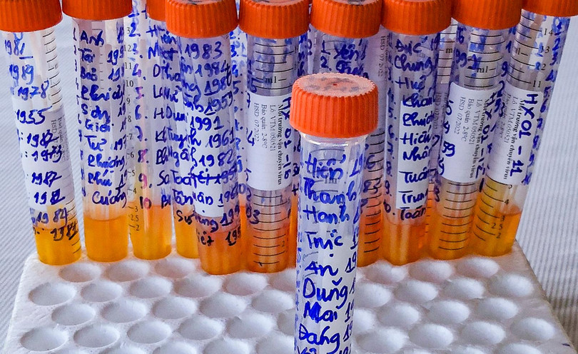 Mẫu xét nghiệm SARS-CoV-2