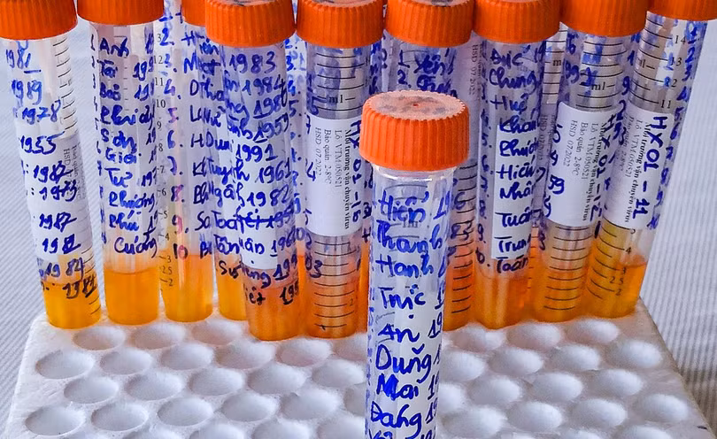 Xét nghiệm COVID-19 theo hình thức mẫu gộp được áp dụng tại Đà Nẵng trong bối cảnh dịch bùng phát vào năm 2021