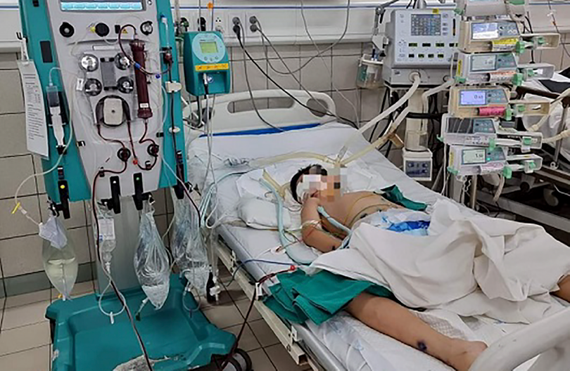 Bệnh nhi được điều trị kèm chỉ định lọc máu liên tục