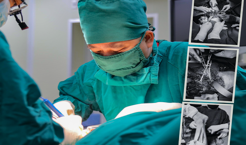 Các bác sĩ Bệnh viện đa khoa Đức Giang (Hà Nội) đang phẫu thuật nối chân cho bệnh nhân