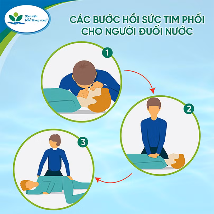 Hướng dẫn cấp cứu đối với người bị đuối nước (ảnh: Bệnh viện cung cấp)