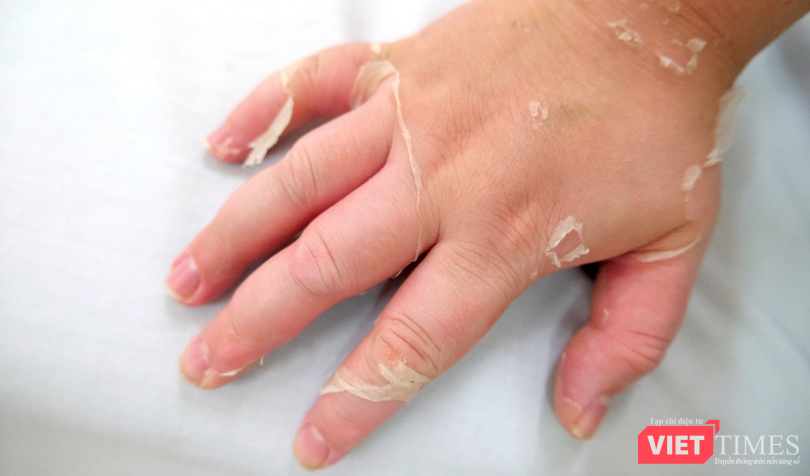 vt_lam dung thuoc xit mui 1.png