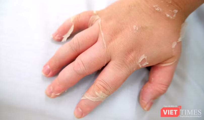 vt_lam dung thuoc xit mui 1.png