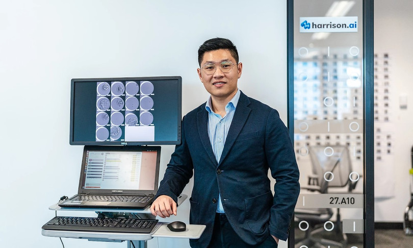 Aengus Tran (Đình Áng) được anh trai gọi là linh hồn của dự án vì đã tạo ra công nghệ từ khi Minh Trí còn ngồi ghế giảng đường Đại học y New South Wales Aengus Tran (Đình Áng) được anh trai gọi là linh hồn của dự án vì đã tạo ra công nghệ từ khi Minh Trí còn ngồi ghế giảng đường Đại học y New South Wales